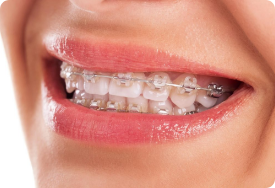 大人の矯正 西宮市苦楽園口のかすや矯正歯科