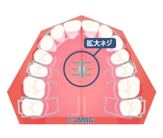 >第一期治療について