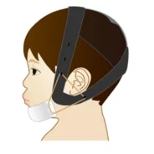 チンキャップ
